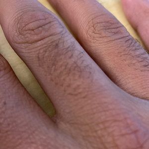 My knuckle hair